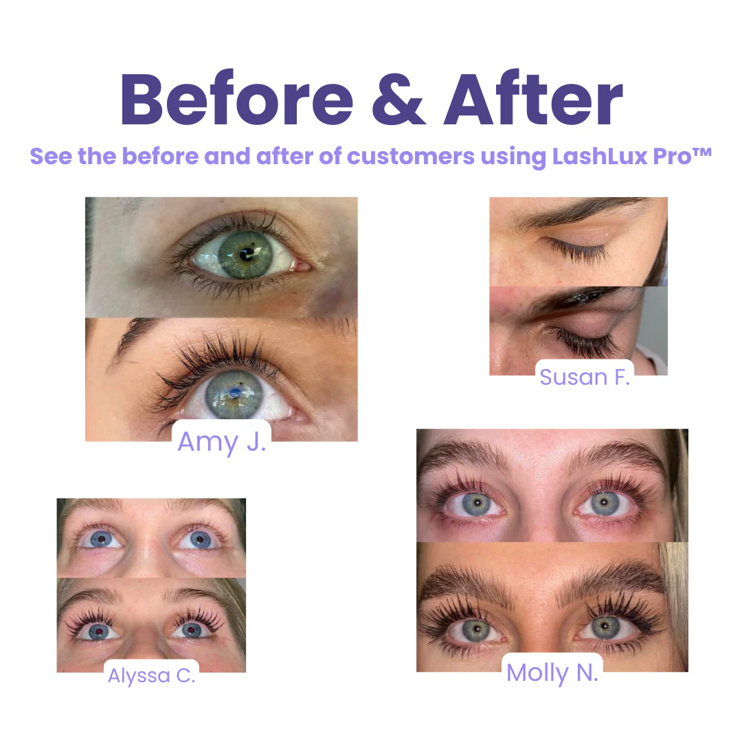 The RapidLash  Eyelash Enhancing Serum - Longer Lashes in 7 Days + BUY 1 GET 1 FREE! - Image 3