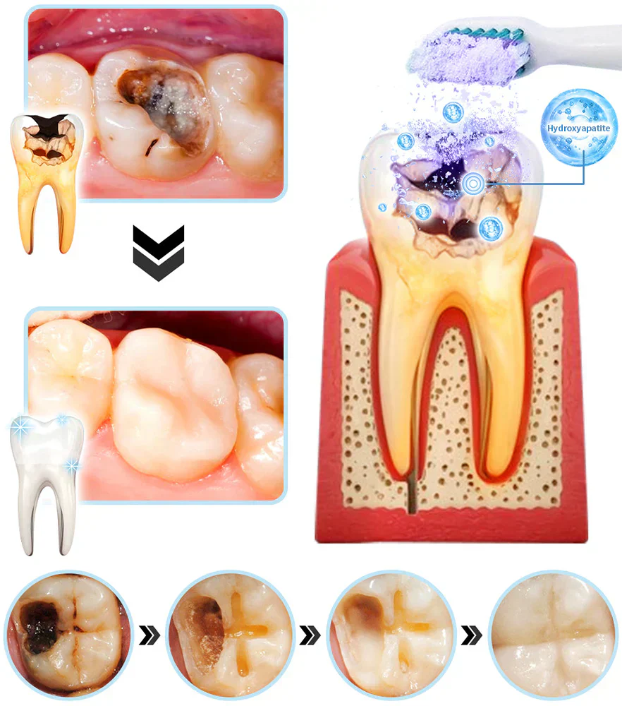 DENTASHIELD – Restore Your Natural Dental Bio-Barrier + 50% OFF FLASH SALE - Image 2
