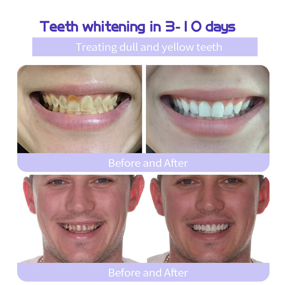 DENTASHIELD – Restore Your Natural Dental Bio-Barrier + 50% OFF FLASH SALE - Image 4
