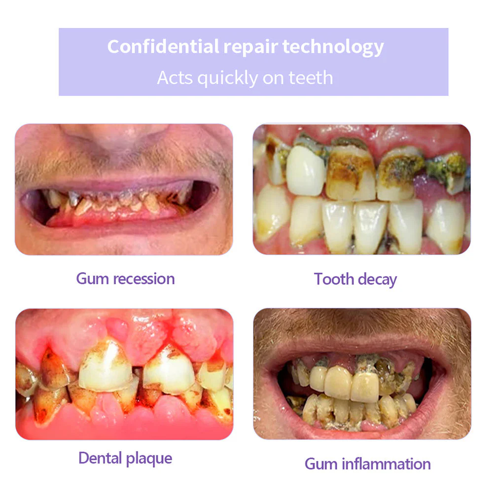 DENTASHIELD – Restore Your Natural Dental Bio-Barrier + 50% OFF FLASH SALE - Image 5